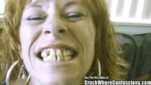 Donkey Teeth Red Head mom Crack Slut